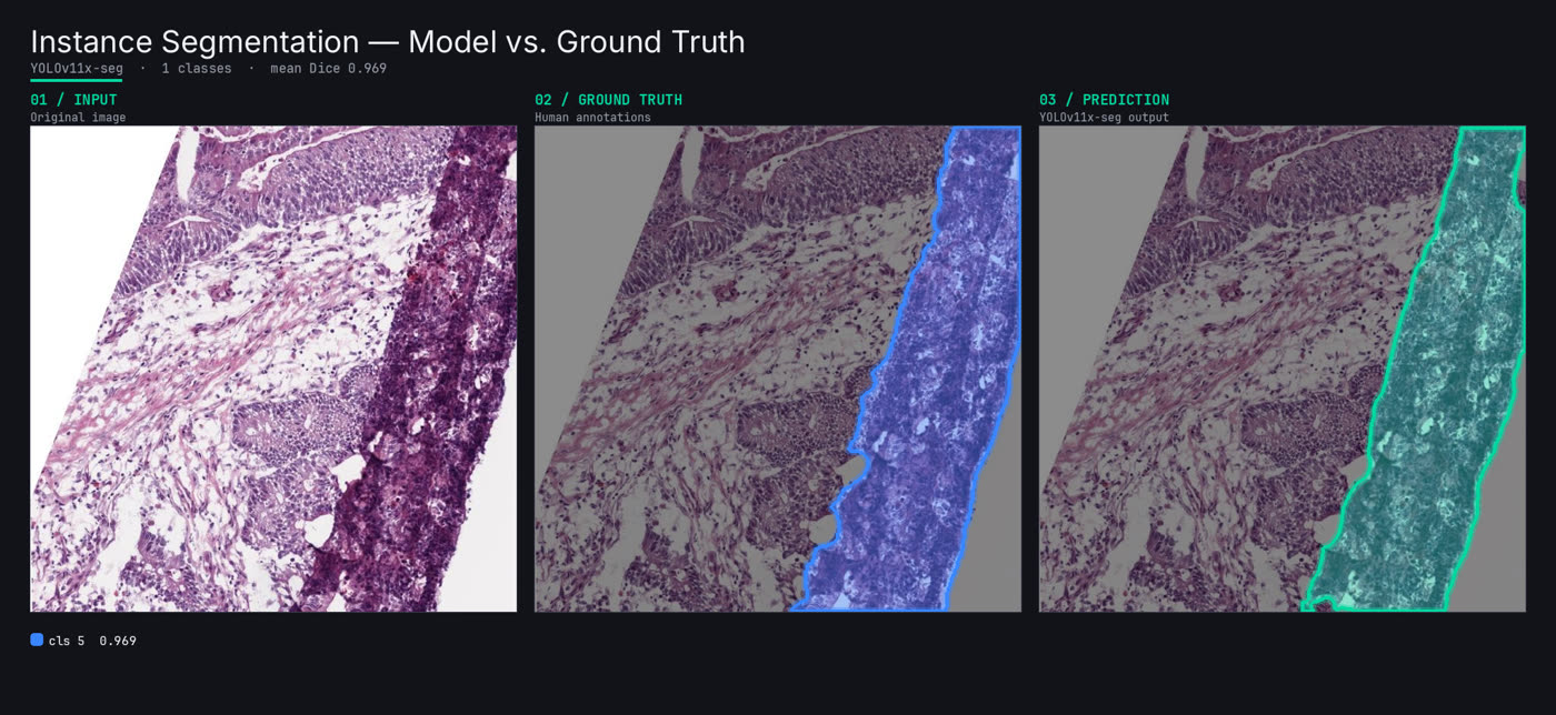 Pathology slide instance segmentation: input, human ground-truth mask, and YOLO11x-seg prediction side by side
